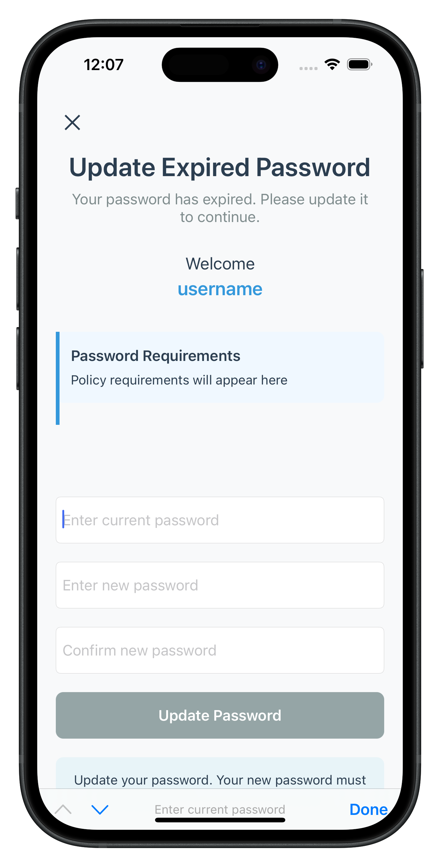 Expiry Update Password Screen